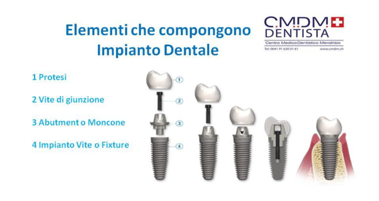 Implantologia